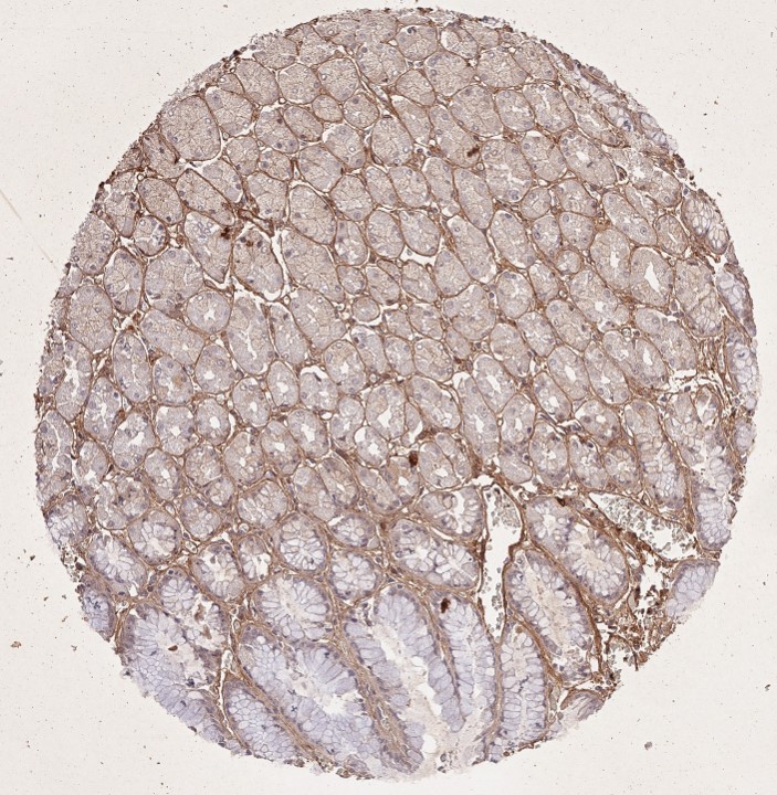 Immunohistochemistry of Rabbit Anti-Collagen Type I