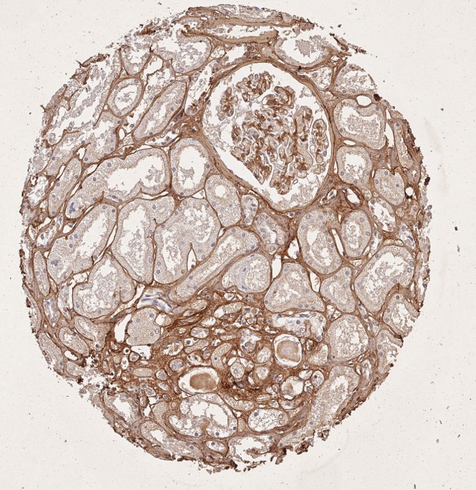 Immunohistochemistry of Rabbit Anti-Collagen Type I