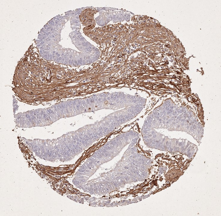 Immunohistochemistry of Rabbit Anti-Collagen Type I