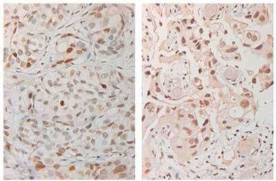 Anti-ATM Monoclonal Antibody-Immunohistochemistry