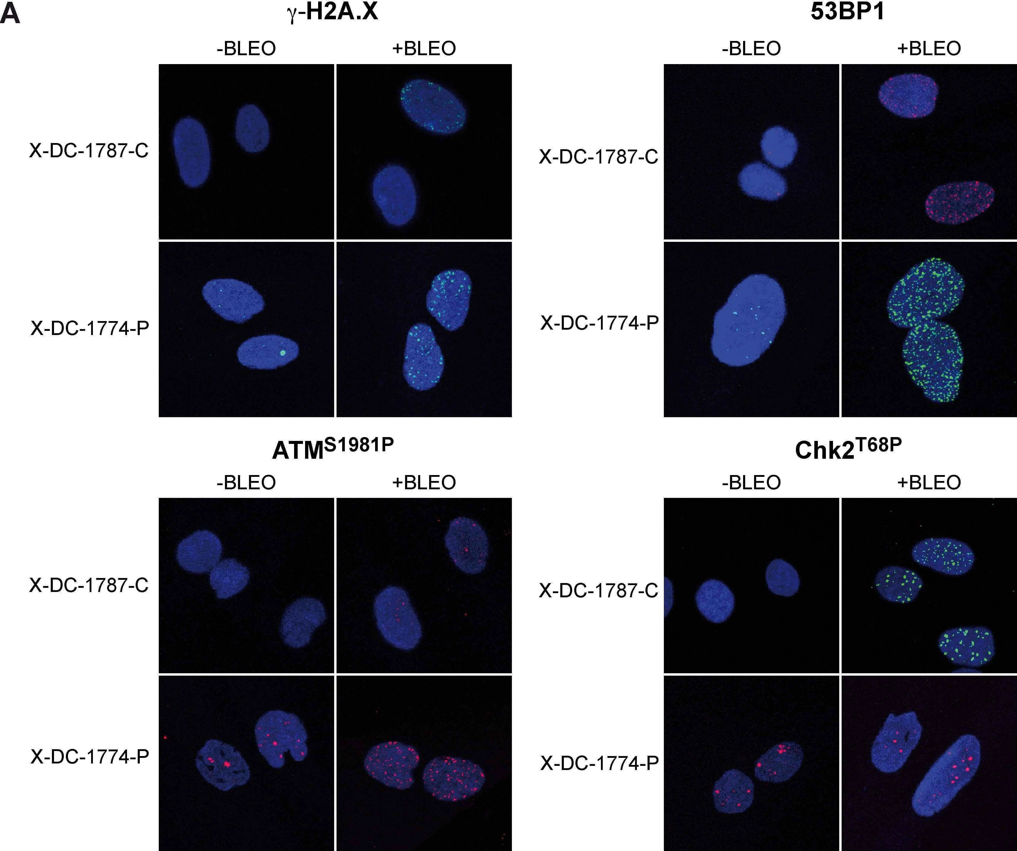 Western Blot of Anti-ATM pS1981