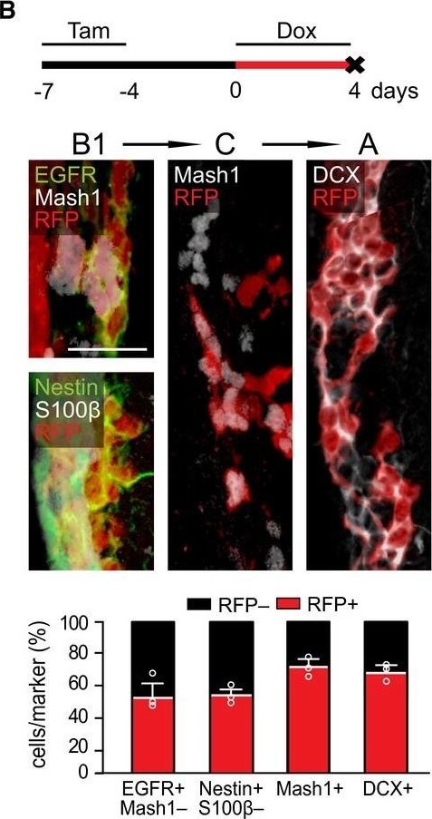 Immunohistochemistry of Anti-RFP