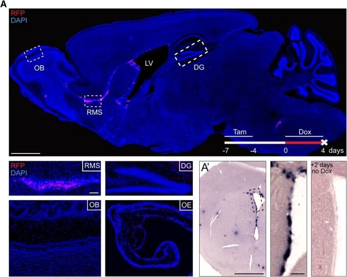 Immunohistochemistry of Anti-RFP