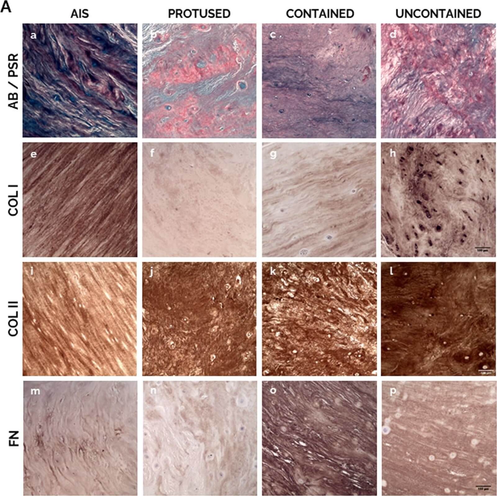 IHC of Anti-Collagen Type I