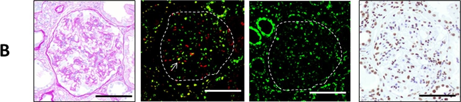 Immunohistochemistry of Anti-ATM pS1981