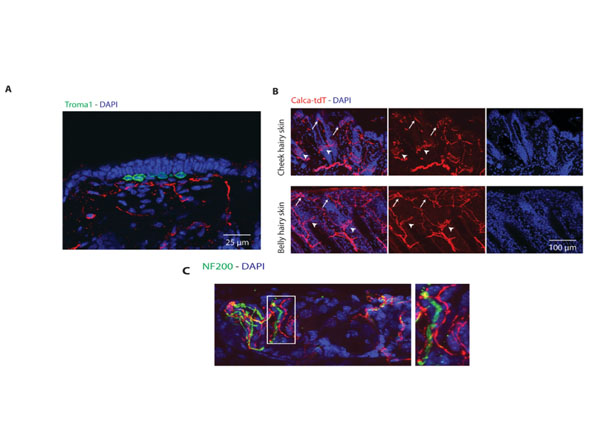 Immunostaining using Normal Goat Serum