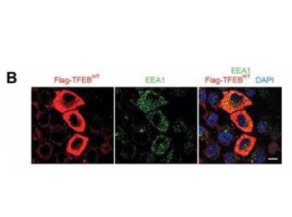 Immunofluorescence using Goat Serum