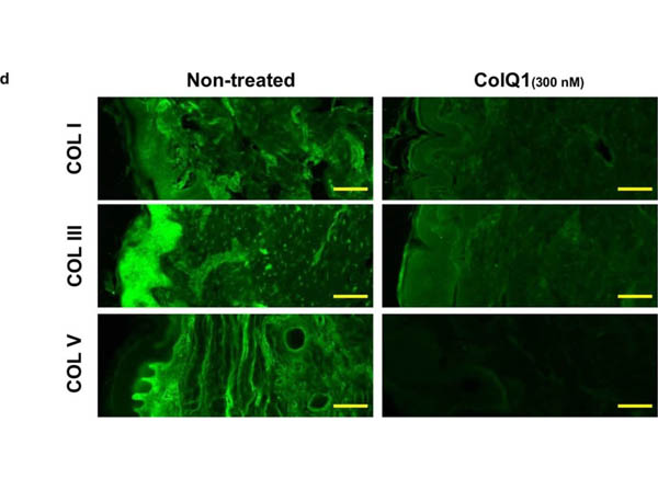 Immunocytochemistry of Anti-Collagen Type I