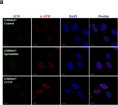 Immunocytochemistry of Anti-ATM pS1981