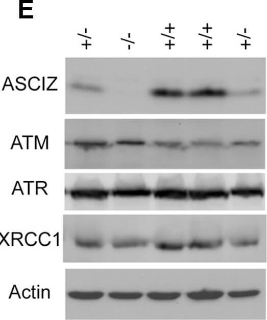 Immunostaining of Anti-ATM pS1981