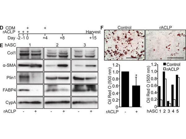 Western Blot of Anti-Collagen Type I