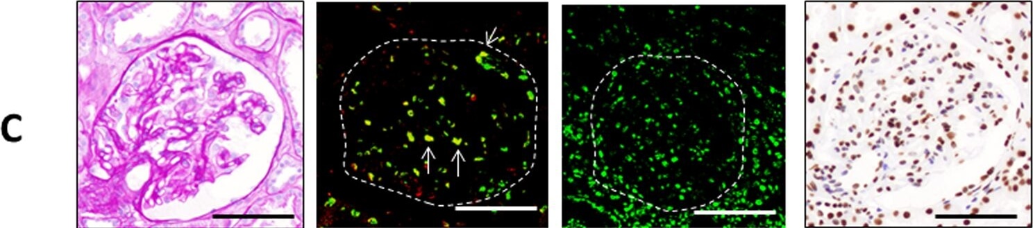 Immunohistochemistry of Anti-ATM pS1981