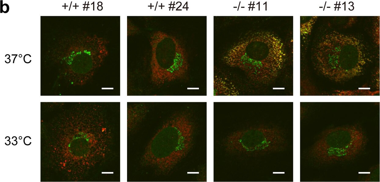 Immunocytochemistry of Anti-Collagen Type I