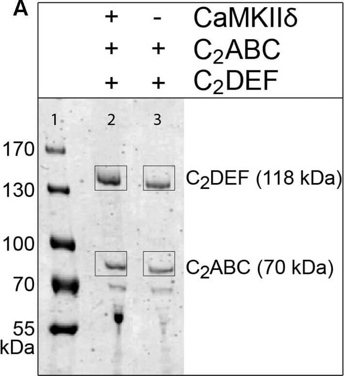 Western Blot of Mouse anti-RFP