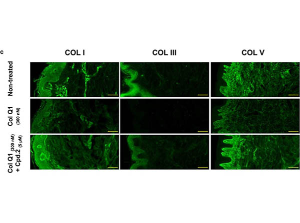 Immunocytochemistry of Anti-Collagen Type I