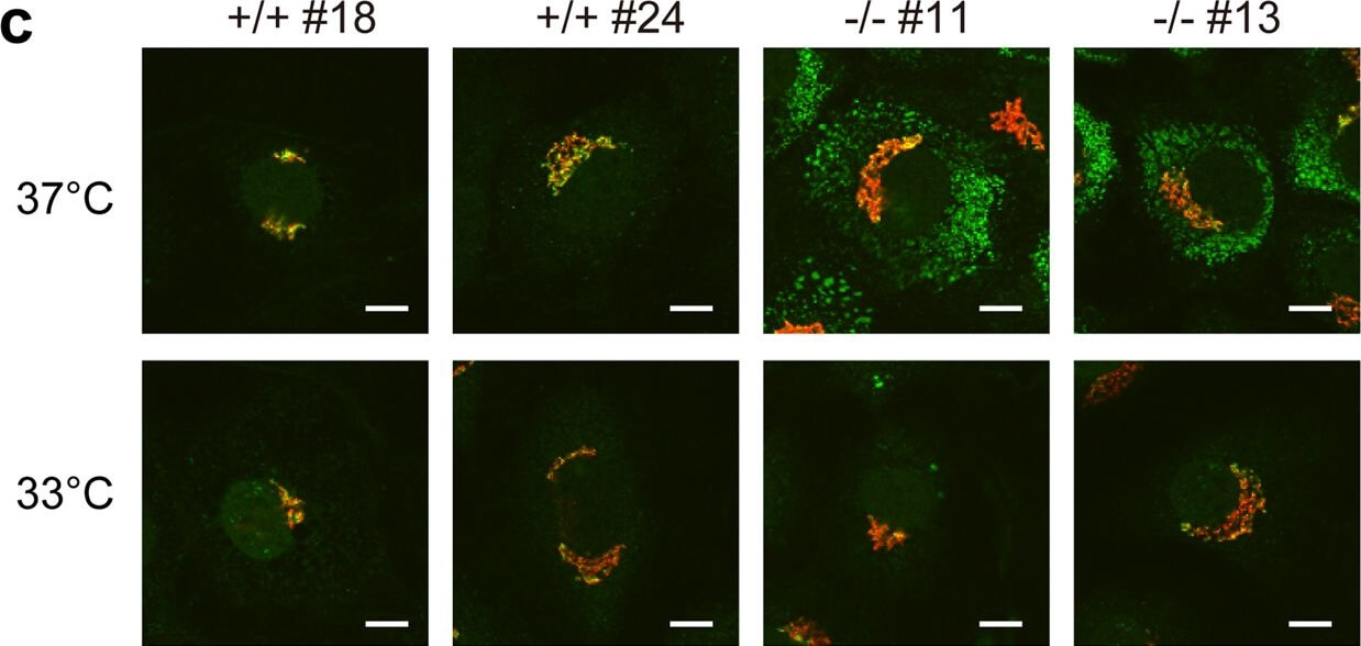 Immunocytochemistry of Anti-Collagen Type I