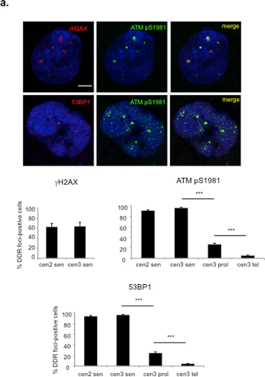 Immunocytochemistry of Anti-ATM pS1981