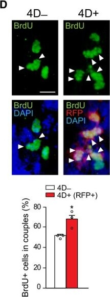 Immunohistochemistry of Anti-RFP