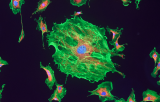 Sonde NUP98 pour l'HIS CE/IVD - Leucémie myéloïde aiguë (AML)