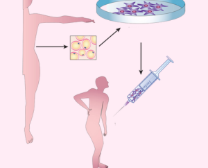 Applications médicales et thérapeutiques des cellules souches 