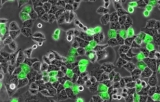 Analyse des données des essais de cicatrisation et de migration cellulaire